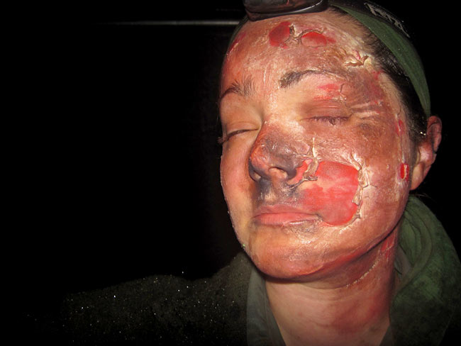 Aspirant Instructor Sarah Day plays her part in a burns scenario